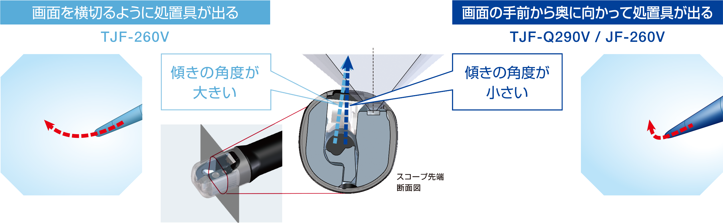 EVIS LUCERA ELITE 十二指腸ビデオスコープ TJF-Q290V|製品情報