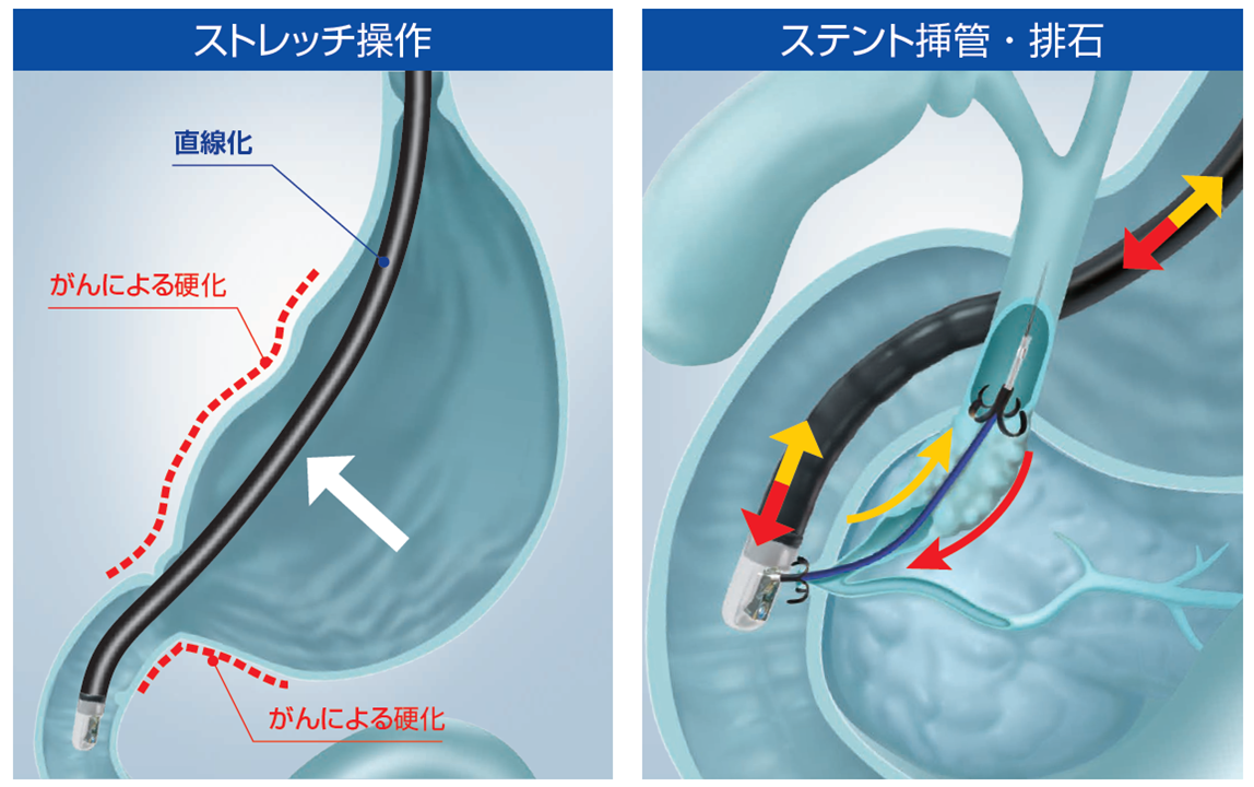 EVIS LUCERA ELITE 十二指腸ビデオスコープ TJF-Q290V|製品情報|オリンパス医療ウェブサイト メディカルタウン