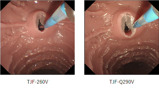 EVIS LUCERA ELITE 十二指腸ビデオスコープ TJF-Q290V|製品情報|オリンパス医療ウェブサイト メディカルタウン