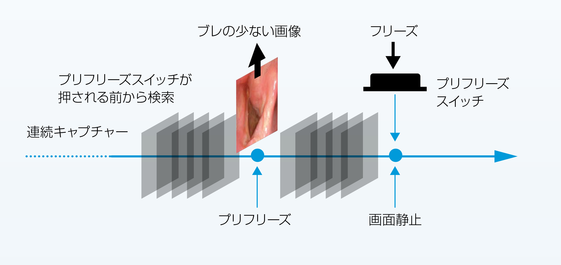 内視鏡システム OTV-SI2|製品情報|オリンパス医療ウェブサイト メディカルタウン